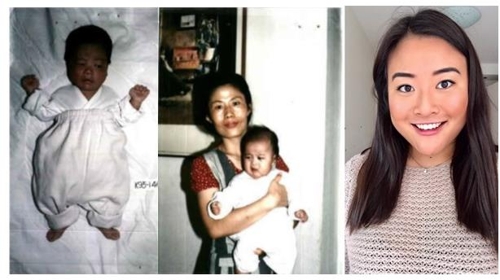도우미 씨의 출생 당시 사진(좌측)과 가운데는 위탁모가 안고 있는 모습(가운데)이고 오른쪽은 현재
