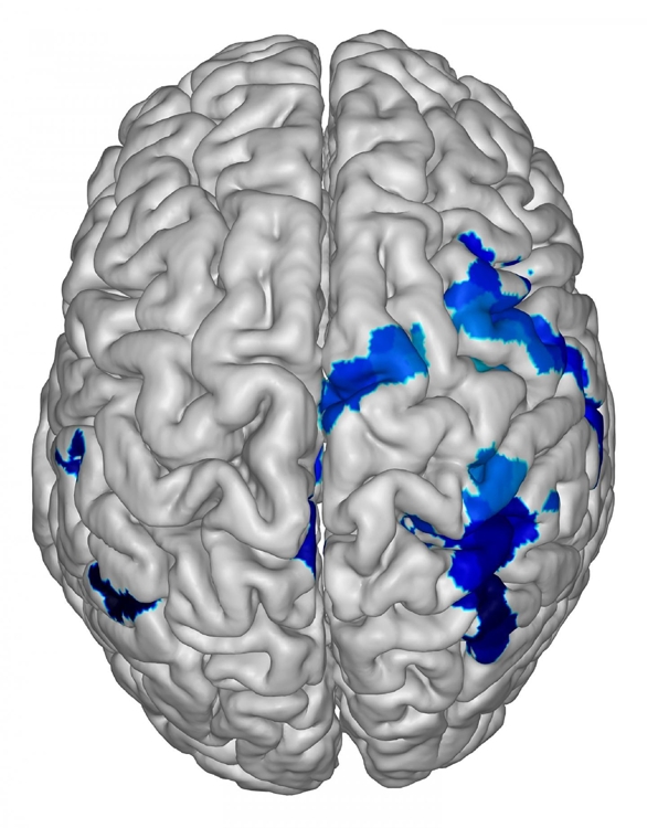 '학습과 기억' 실험서 관찰한 뇌