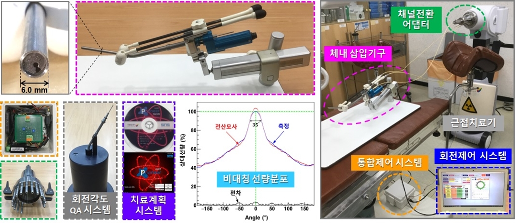 세기 조절 근접 방사선 치료 시스템 구성과 삽입기구 주변 선량분포