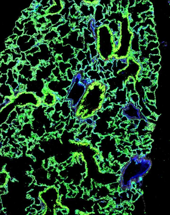 줄기세포가 이식된 생쥐의 폐(전자현미경 이미지) 