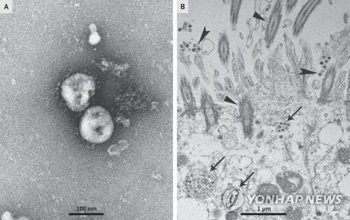 배양된 신종 코로나바이러스를 광학현미경으로 관찰한 모습