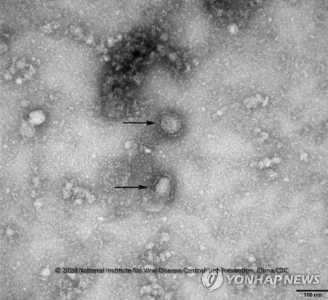 신종 코로나바이러스(코로나19) 전자현미경 사진