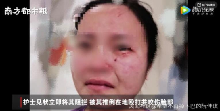 중국서 '코로나19 확진 외국인' 채혈검사 거부하며 간호사 폭행