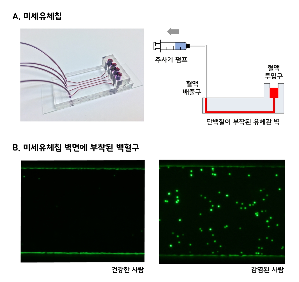 미세 유체 칩의 구조와 유체 관에 부착된 백혈구