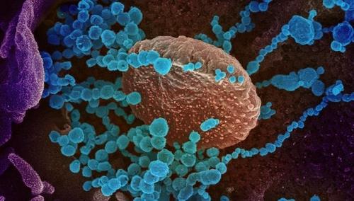신종 코로나바이러스배양 세포 표면에서 나오는 신종 코로나바이러스(청색)의 전자현미경 이미지[미 NIAID 제공 / 재판매 및 DB 금지]