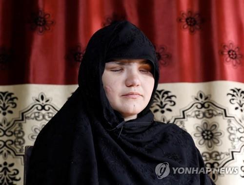 직업을 가졌다는 이유로 실명당한 아프간 여경 카테라