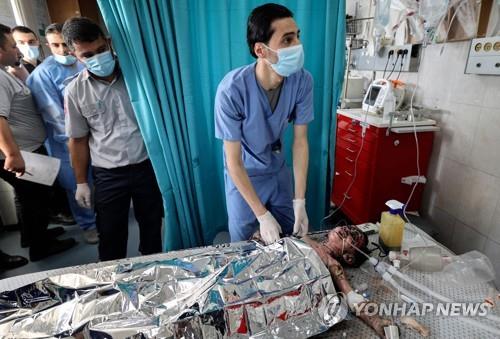 이스라엘의 보복 공습으로 화상을 입은 가자지구 아동이 치료를 받고 있다