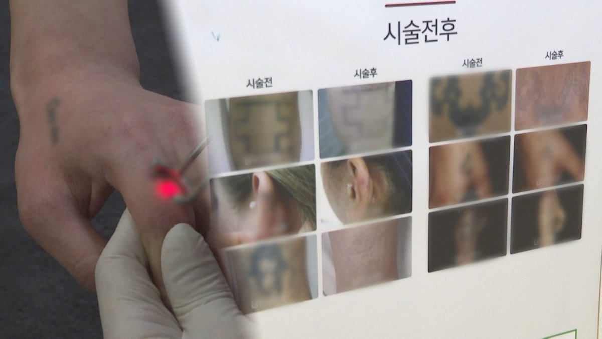 청소년 문신·흉터 제거 지원…심리상담 병행