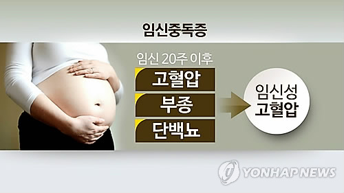 임신중독증(CG)