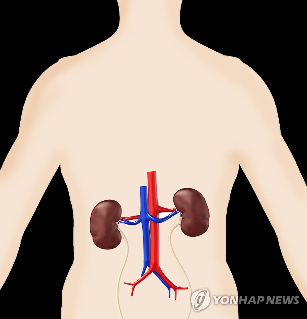 신장질환 (일러스트)