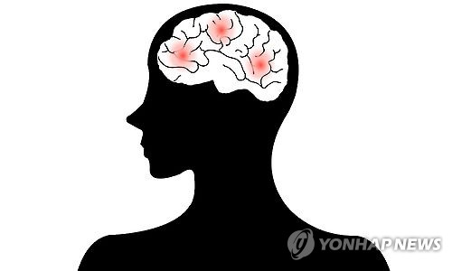 기온 뚝 떨어진 초겨울 불청객 '뇌졸중' 주의