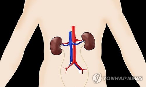 신장질환(그래픽)