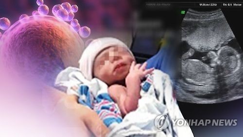 "생활용품 화학물질 탓 임신 가능성 떨어진다"