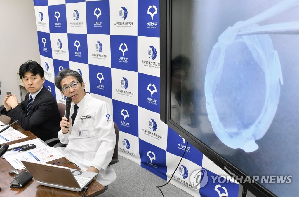 일본 오사카대 줄기세포 이용 각막이식 세계 첫 실시