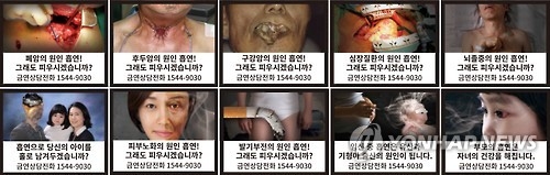 S. Koreans support graphic warnings covering 80 pct of cigarette packs: poll - 1
