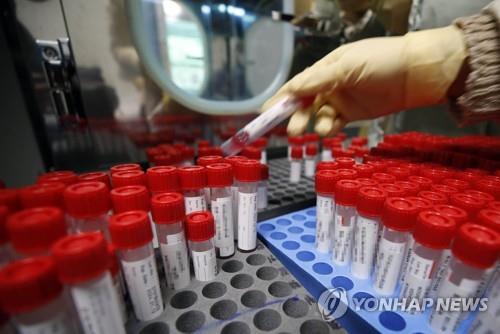 A medical worker checks COVID-19 test samples at a makeshift testing station in the southwestern city of Gwangju on Feb. 23, 2022, in this photo provided by a local government. (PHOTO NOT FOR SALE) (Yonhap)