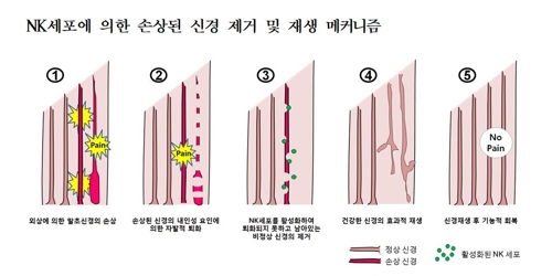 자연살해세포에 의한 손상 신경 제거 및 재생 과정