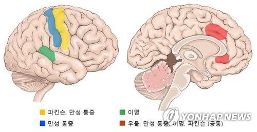 브레인포그 증상, 과다 수면 상태에 3