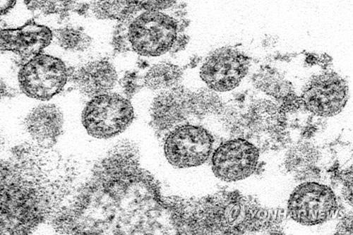 미국 질병통제예방센터가 공개한 신종 코로나바이러스(SARS-CoV-2) 현미경 사진. [AP=연합뉴스 자료사진]