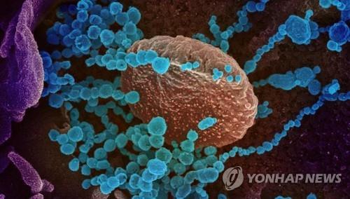 배양 세포 표면에서 나오는 신종 코로나바이러스(청색)의 전자현미경 이미지[미 NIAID 제공 / 재판매 및 DB 금지]