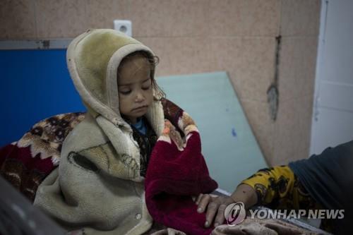 영양실조로 카불 어린이병원에 입원한 어린이