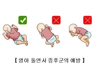 영아 돌연사 증후군 예방을 위한 수면 자세