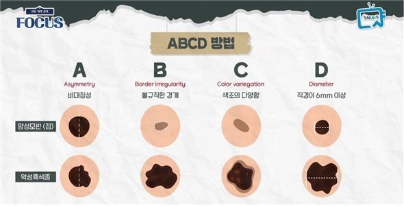 [위클리 건강] 