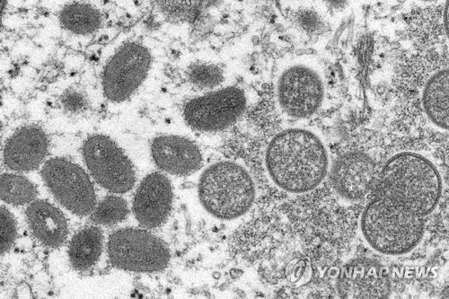 현미경에 포착된 원숭이두창 바이러스