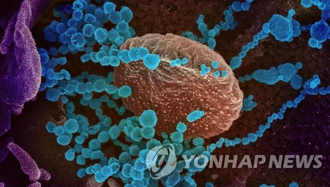 배양 세포 표면에서 나오는 신종 코로나바이러스(청색)의 전자현미경 이미지[미 NIAID 제공 / 재판매 및 DB 금지]
