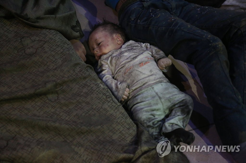 2018년 시리아서 사린가스 공격 받은 아기