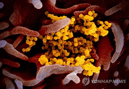 신종 코로나바이러스 전자현미경 사진