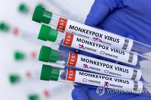 미, 민간시설에서도 원숭이두창 감염 검사