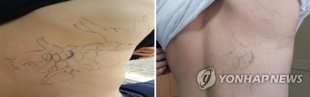 타투 300만 시대_사실상 세계 유일의 '타투 불법' 국가